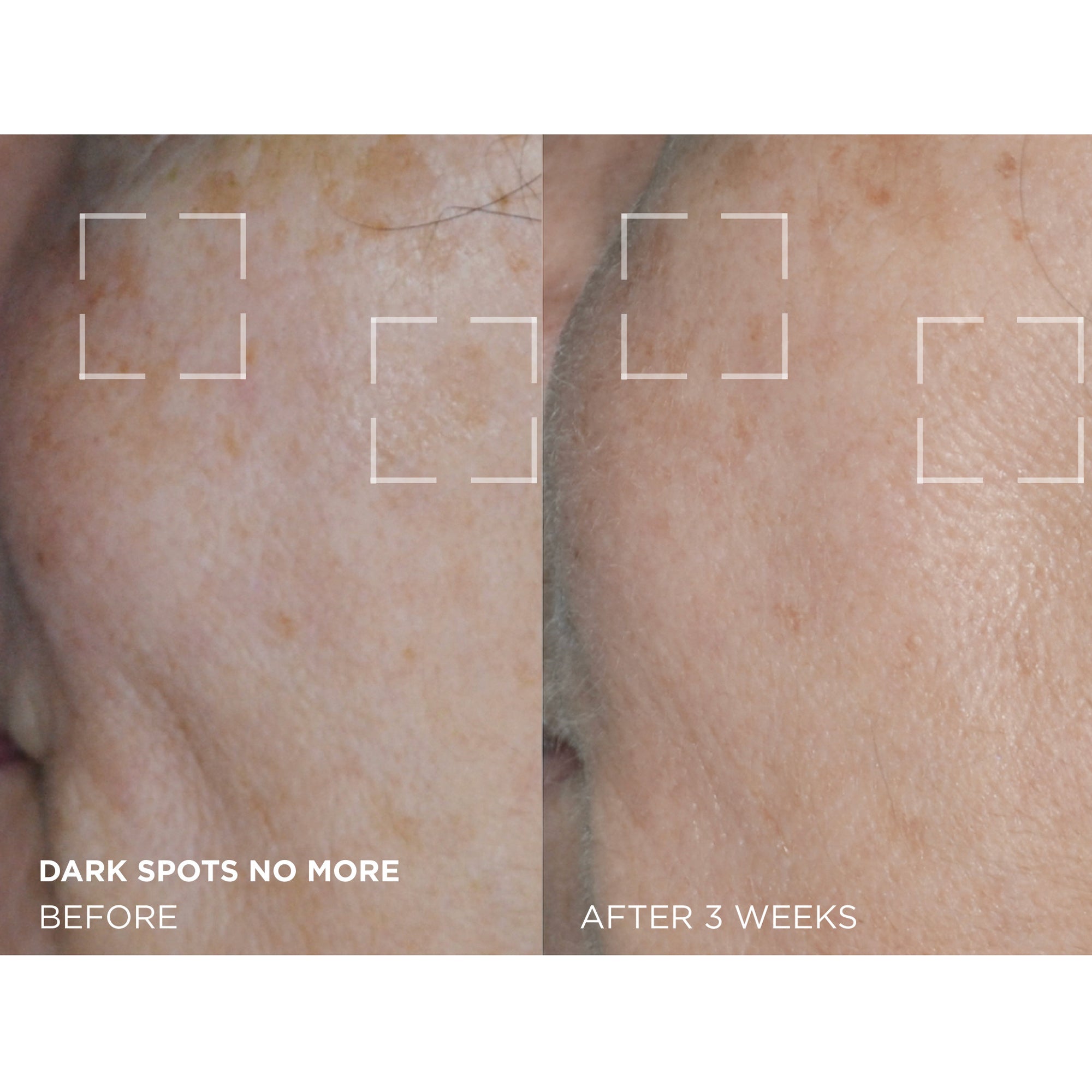 Dark Spots No More Triple Acid Spot Minimizing Concentrate